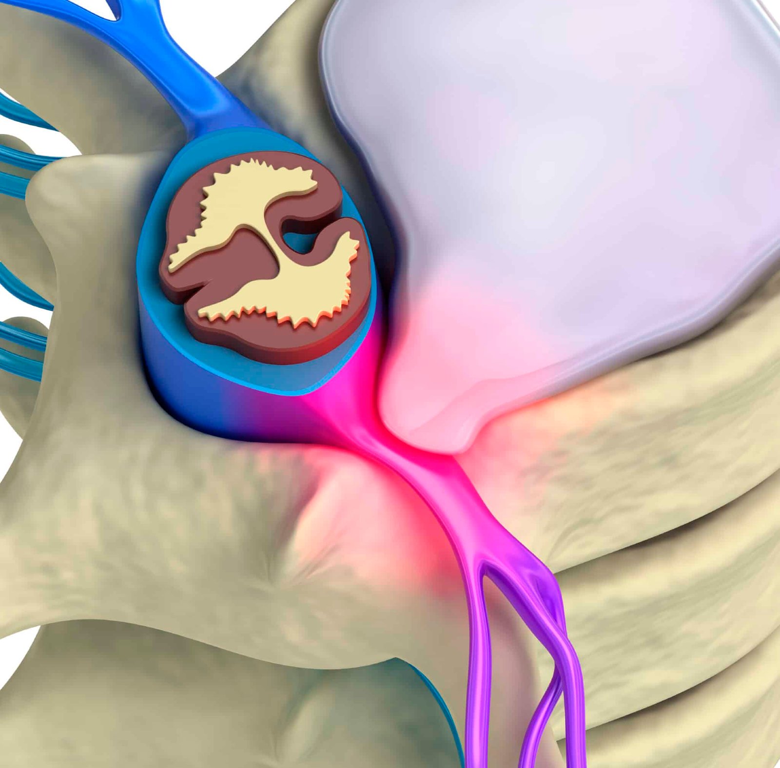 El ejercicio a la osteocondrosis butrimova