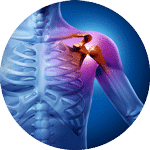 bursitis-quiropratico150