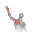 sindrome-salida-toracica